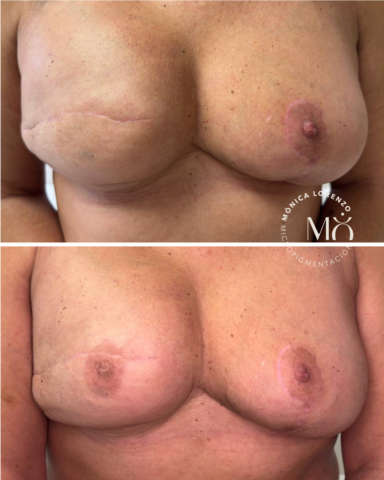 micropigmentación de areola con efecto 3d