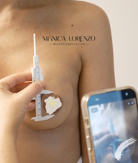 Medición de la areola para personalizar la prótesis de areola y pezón