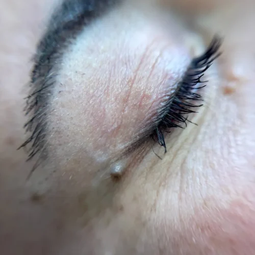 linea-de-ojos-micropigmentacion-antes-despues-laspalmas