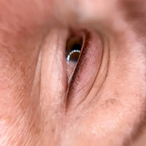 micropigmentacion-de-ojos-laspalmas-clinica-especializada