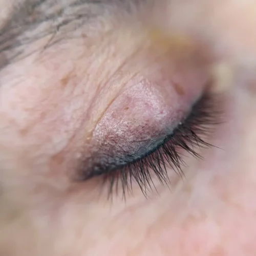 micropigmentacion-eyeliner-difuminado-laspalmas