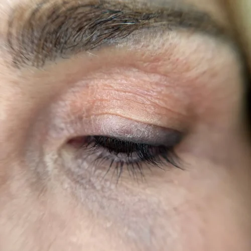 micropigmentacion-eyeliner-superior-laspalmas