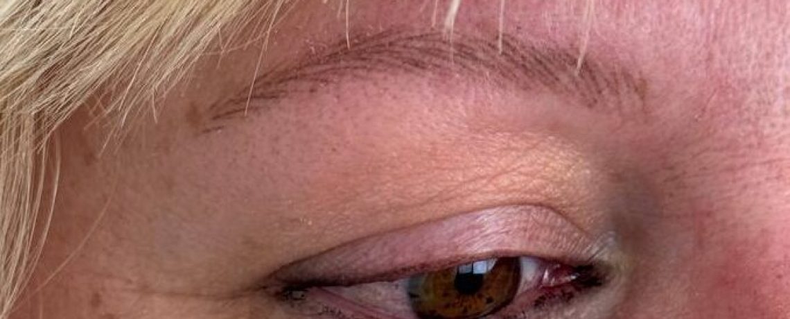 cejas sombreadas en alopecia frontal fibrosante Canarias y Madrid