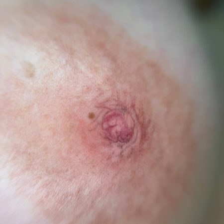 Micropigmentacion areola 3D