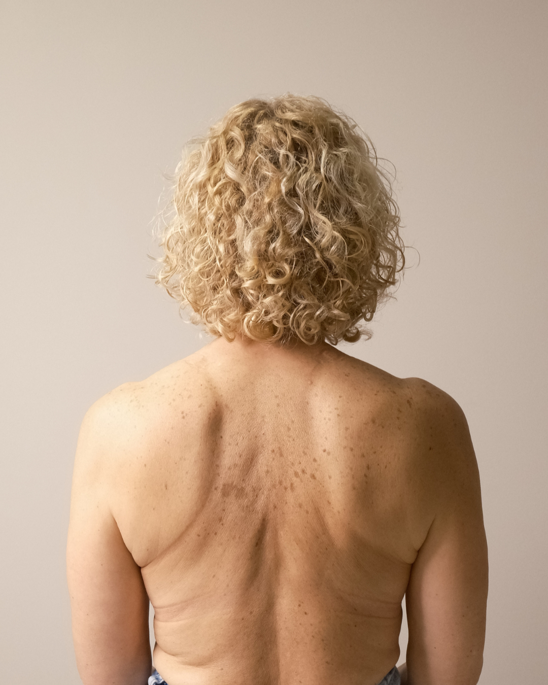 micropigmentacion-areola-reconstruccion-mama-monica-lorenzo