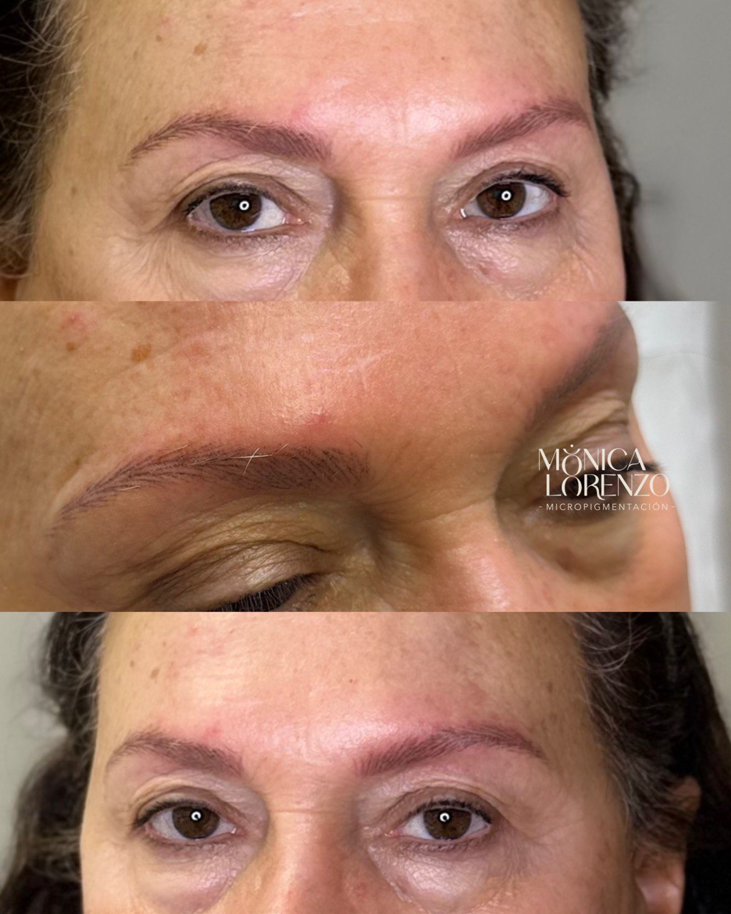 Micropigmentación de cejas en Las Palmas con técnica pelo a pelo para recuperar naturalidad en casos de alopecia femenina.