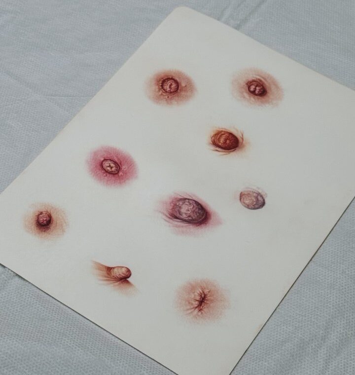 trabajo de realismo en micropigmentacion de areola por Mónica Lorenzo